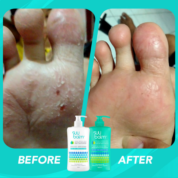 SUU Balm Adult Body Wash Cream Dry Itchy Sensitive Problem Skin 740ml