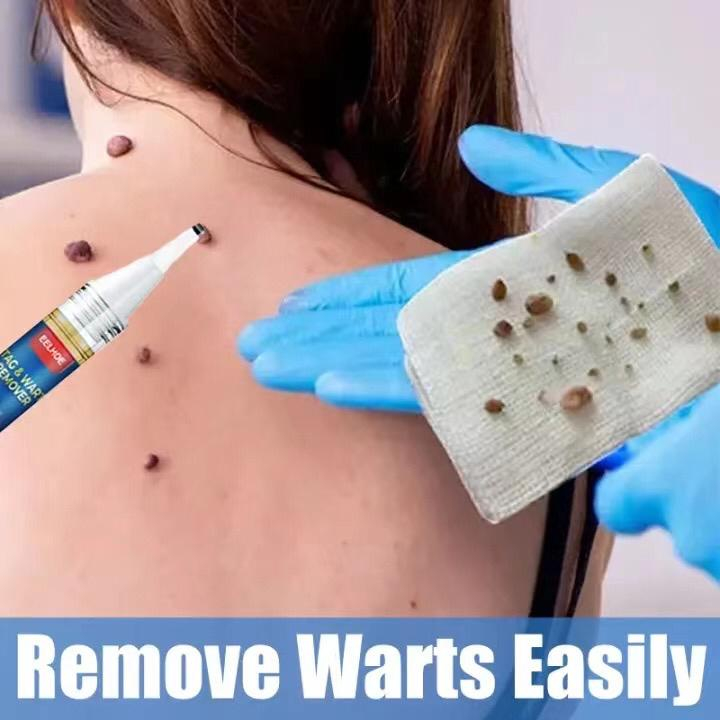 Aurabaik Eelhoe Wart Remover Pen Serum Penghilang Kutil Tahi Lalat Effektif Tag & Wart Remover