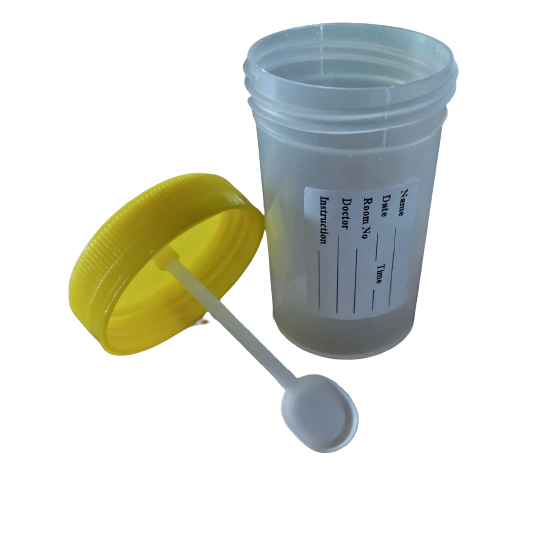 Pot feces 60cc bersendok | Pot feses