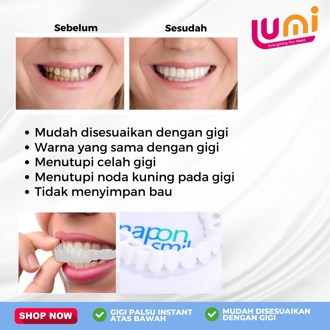 Snap On Smile 100% ORIGINAL Authentic Perawatan Kesehatan Gigi Palsu Renggang Snapon Smile 1 Set