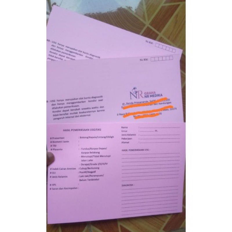 

CETAK KARTU USG BISA CUSTOM GAMBAR | CETAK BOLAK BALIK