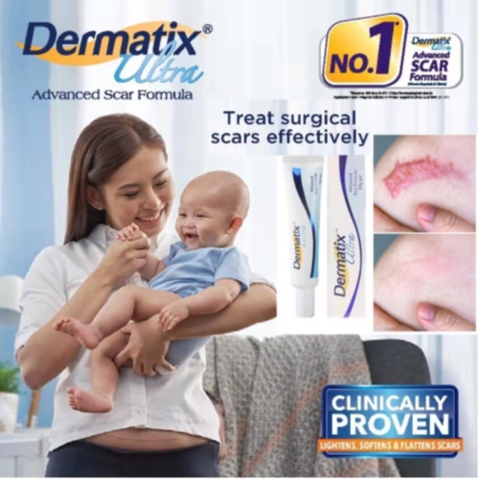 Dermatix Ultra Gel Advanced Scar Formula 15gr Salep Penghilang Bekas Luka/Dermatix Penghilang Bekas Luka/Scar Removal Cream