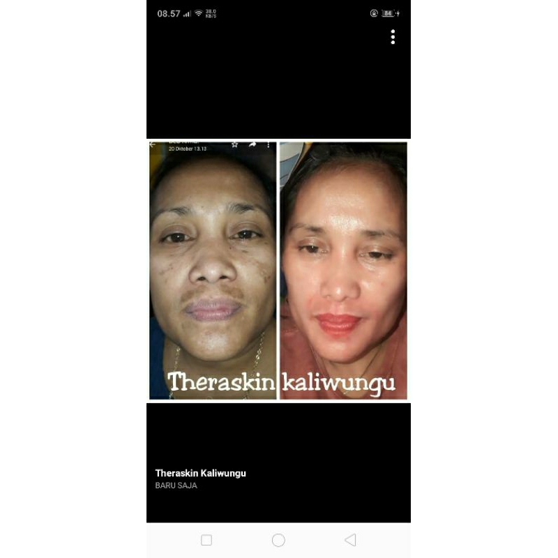 krim Malam Flek glow express by Theraskin kaliwungu