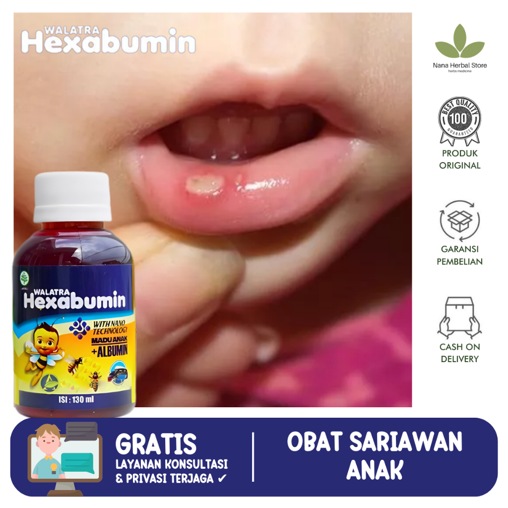 Obat Sariawan Anak, Sariawan Di Lidah, Obat Sariawan Mulut, Obat Jamur Lidah Bayi, Penghilang Jamur 