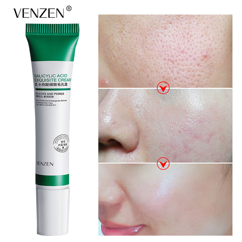 VENZEN Cream Penghilang Pori-Pori Ampuh 20 Ml