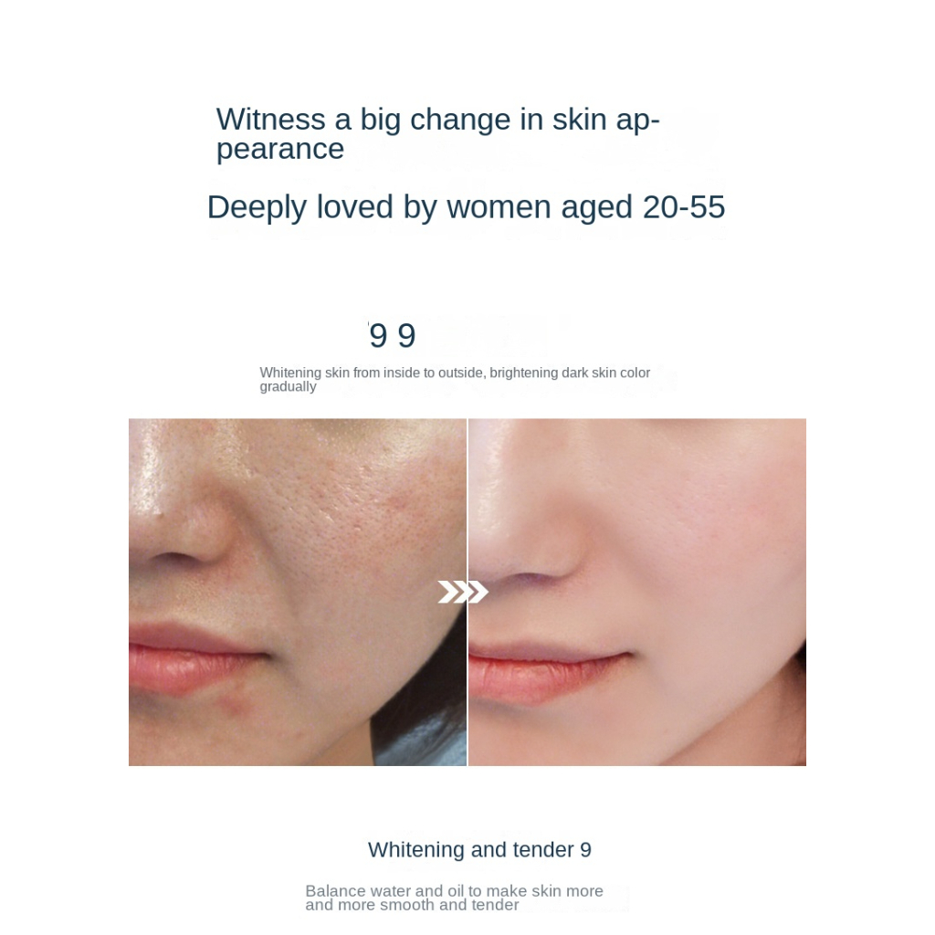 SISKALEY 100ml Nicotinamide Whitening Serum Freckles Remove Dark Spots Melasma Brighten Lighten Melanin Improve Dull Anti-Aging