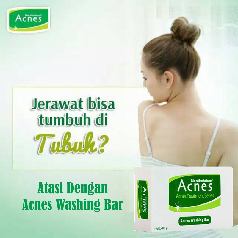 [BPOM] Acnes Washing Bar 80 gr / Acnes Sabun Batang / Sabun Wajah / Sabun Jerawat / Acne Bar Soap / MY MOM