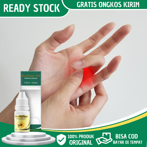 Obat Jari Tangan Sakit dan Kaku, Obat Jari Tangan Kaku dan Kesemutan, Obat Jari Tangan Susah di Teku