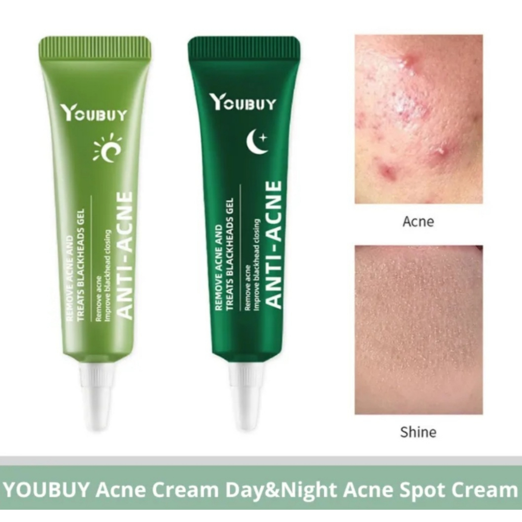 Youbuy anti-acne remove acne and Treats Blackhead / SPOT CARE ACNE TREATMENT /Gel jerawat