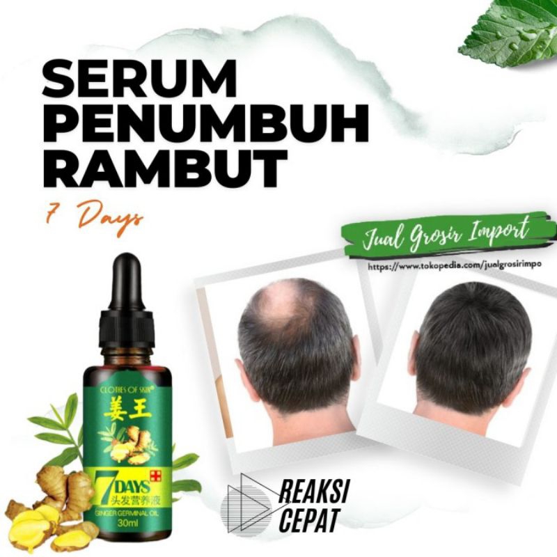 7 day obat penumbuh &amp; penebal rambut bayi dan dewasa menghilangkan rontok pada rambut penumbuhan rambut botak