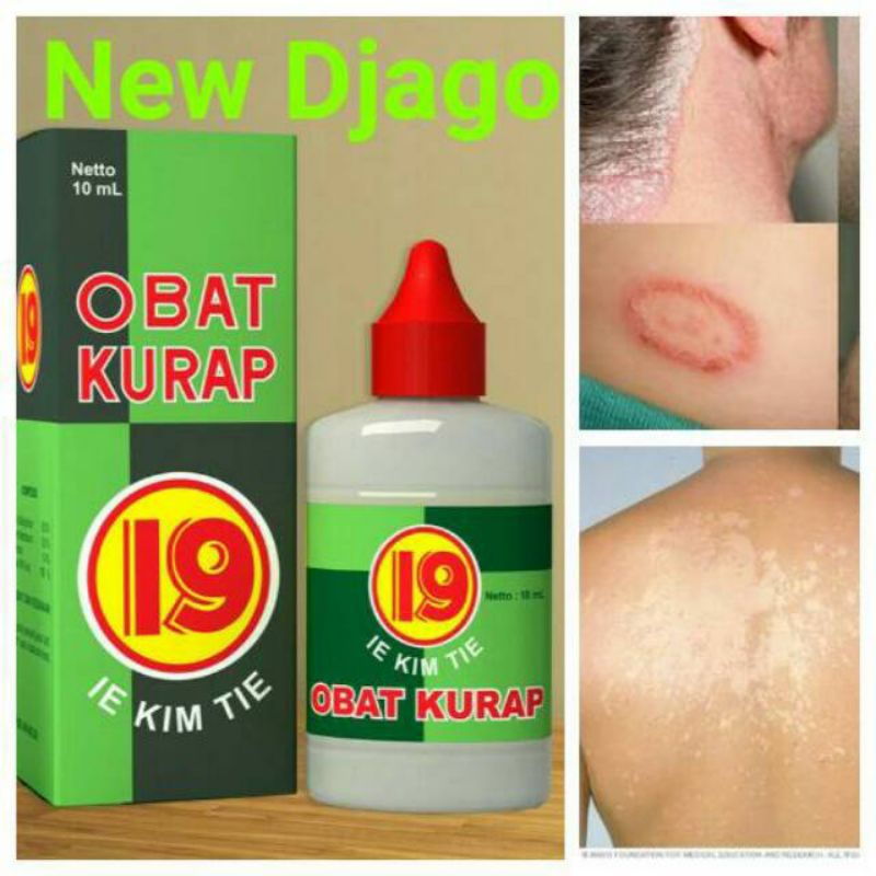 OBAT KURAP PANU 19 IE KIM TIE  AMPUH UNTUK PANU, KADAS, KURAP