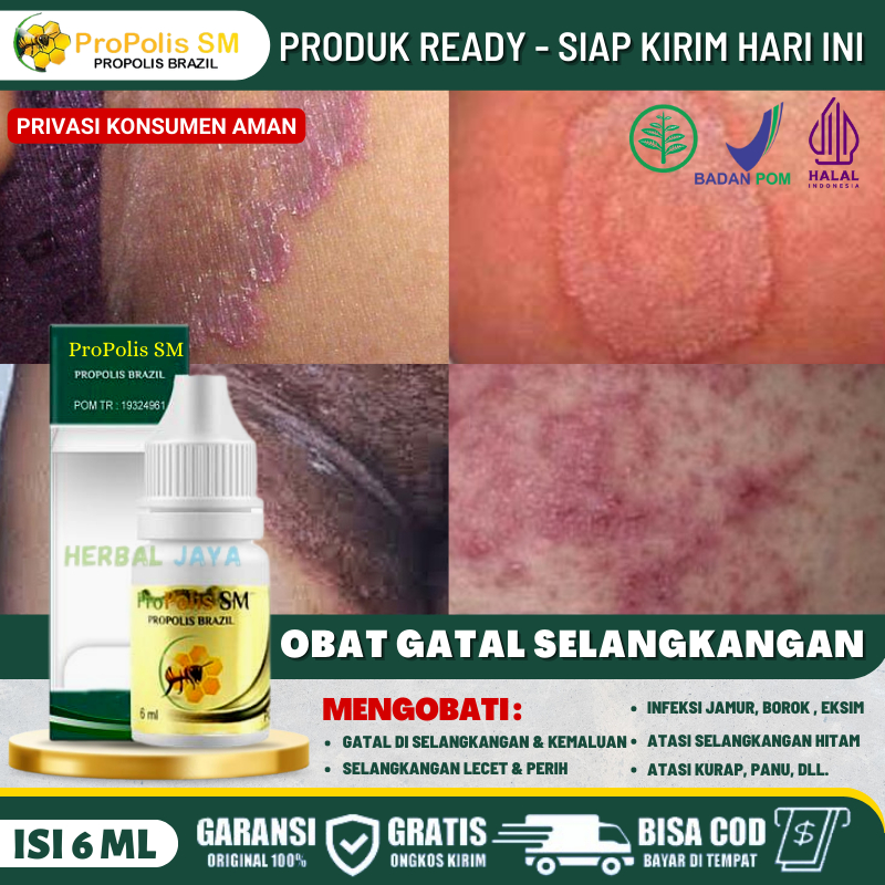 Salep Selangkangan Borok Lecet Bernanah, Salep Penghilang Psoriasis Jamur Hitam di Selangkangan, Sal