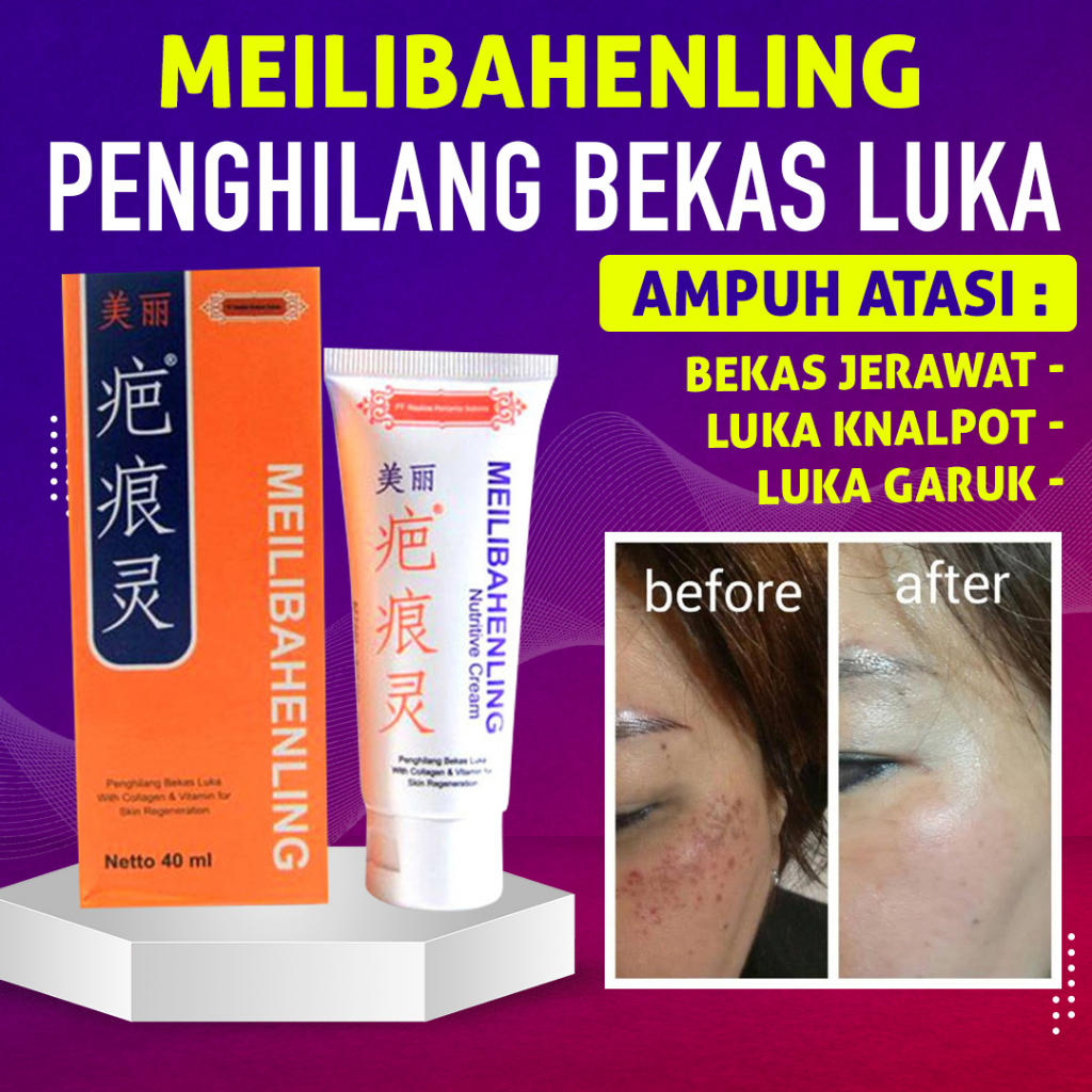 MEILIBAHENLING | PENGHILANG BEKAS LUKA JERAWAT FLEK HITAM | ASLI BPOM 40 ml