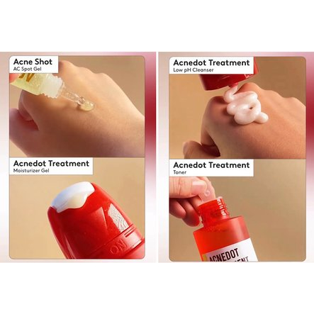 Somethinc Acnedot Treatment