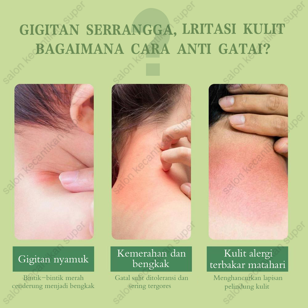 [100% Asli ] Salep gatal Obat gatal paling ampuh Obat gatal kulit 20g Anti gatal cepat/krim  gigitan nyamuk anti-gatal/Balsem gigitan tungau/menghilangkan pembengkakan/Bumil dan bayi dapat menggunakan