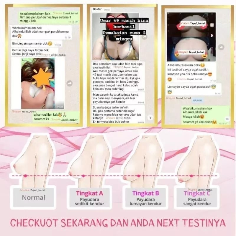 TWINUP MAGIC SERUM | SERUM PEMBESAR &amp; PENGENCANG PAYUDARA | PENGENCANG PAYUDARA BPOM / pembesar pengencang payudara permanen instan alami bpom / pembesar payudaea / twin up / twinup