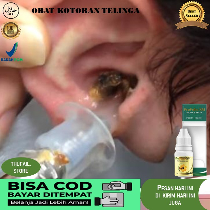 obat kotoran telinga obat tetes telinga kotoran keras Obat Tetes Kotoran Telinga - Penghancur Kotora