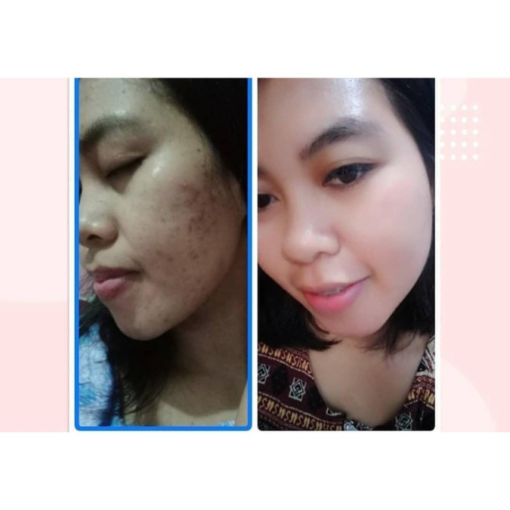 Sabun Batang Batangan Pencerah Pemutih Penghalus Kulit Wajah Muka Tubuh Badan Alami QM Brightening Soap Penghilang Bekas Luka Pengecil Poripori Pria Wanita Ori Cepat Permanen BPOM