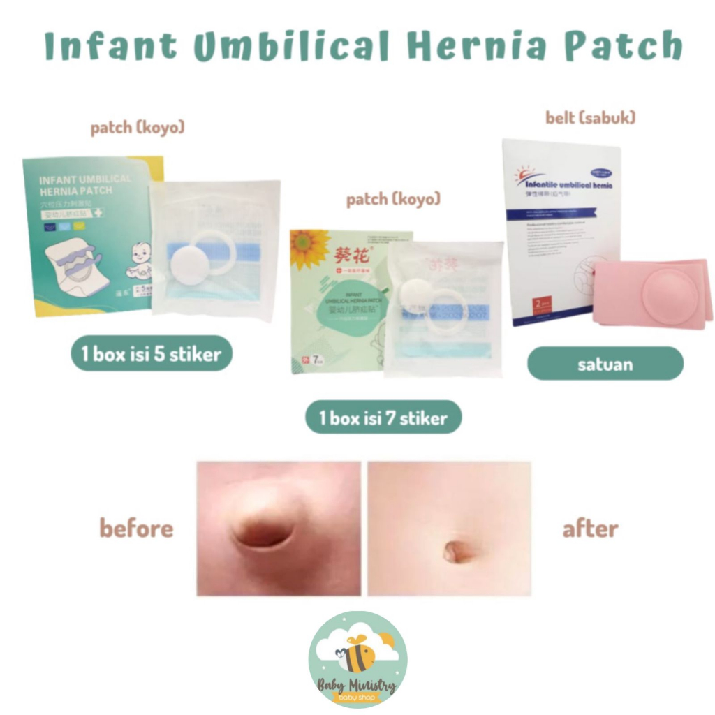 STIKER HERNIA PER BOX / HERNIA PATCH PER BOX/ KOYO HERNIA / ISI 7 / ISI 5 / ANTI AIR / SABUK HERNIA HONS SATUAN/ BABY UMBILICAL HERNIA BELT / SABUK HERNIA / PUSAR BODONG BAYI / SABUK PUSAR BODONG / HERNIA