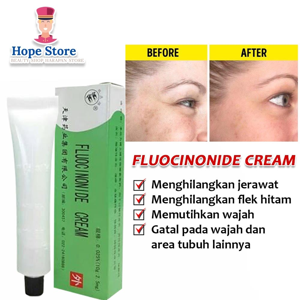 Hope Store - Salep Walet Lightening Cream Lightening Obat Gatal &amp; Penghilang Flek Hitam Membandel Fluocinonide Cream