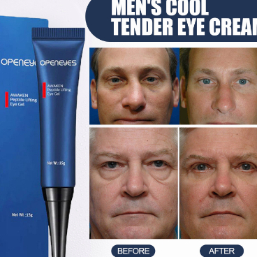 Openeyes east moon Serum Gel Cream Mata Mengencangkan Kulit Mata