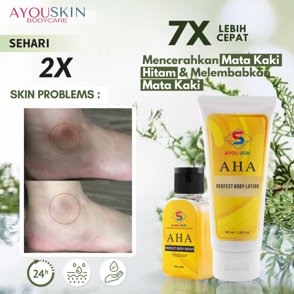 Krim Penghilang Mata Kaki Hitam Dan Kering, Lotion Kapalan Mata Kaki, Flek Pada Mata Kaki Cream Pele