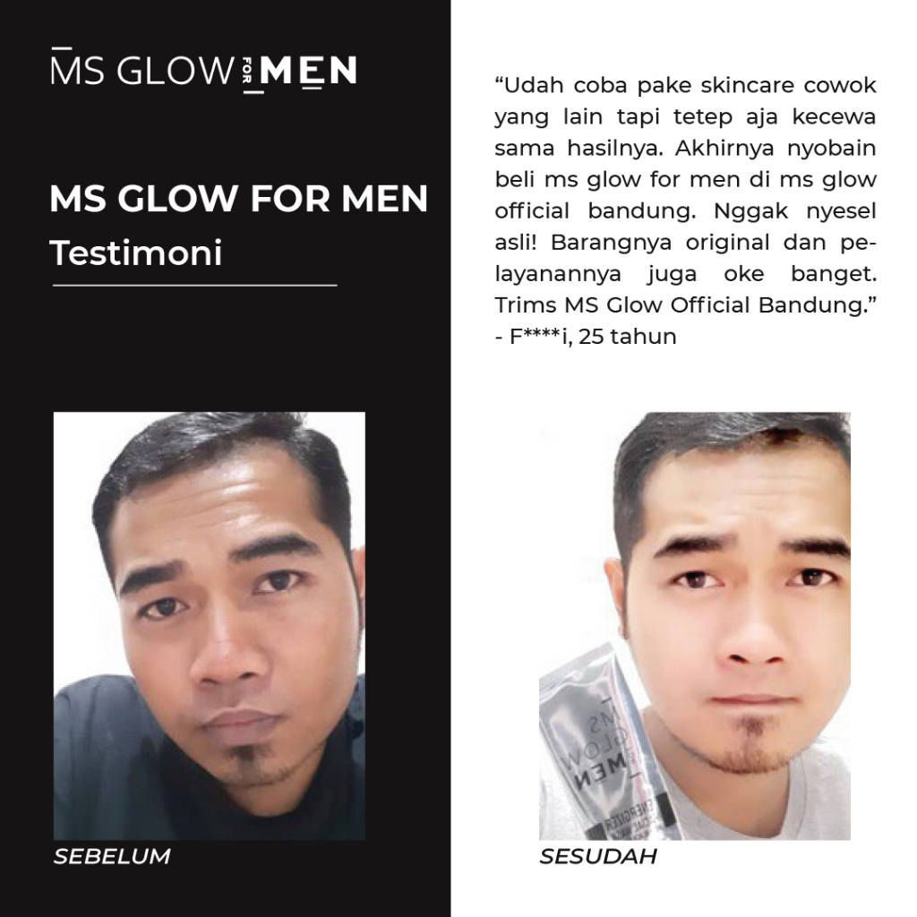 Ms Glow For Men Perawatan Wajah Skincare Bpom Cowok Original Termurah - By Msglowofficialbandung