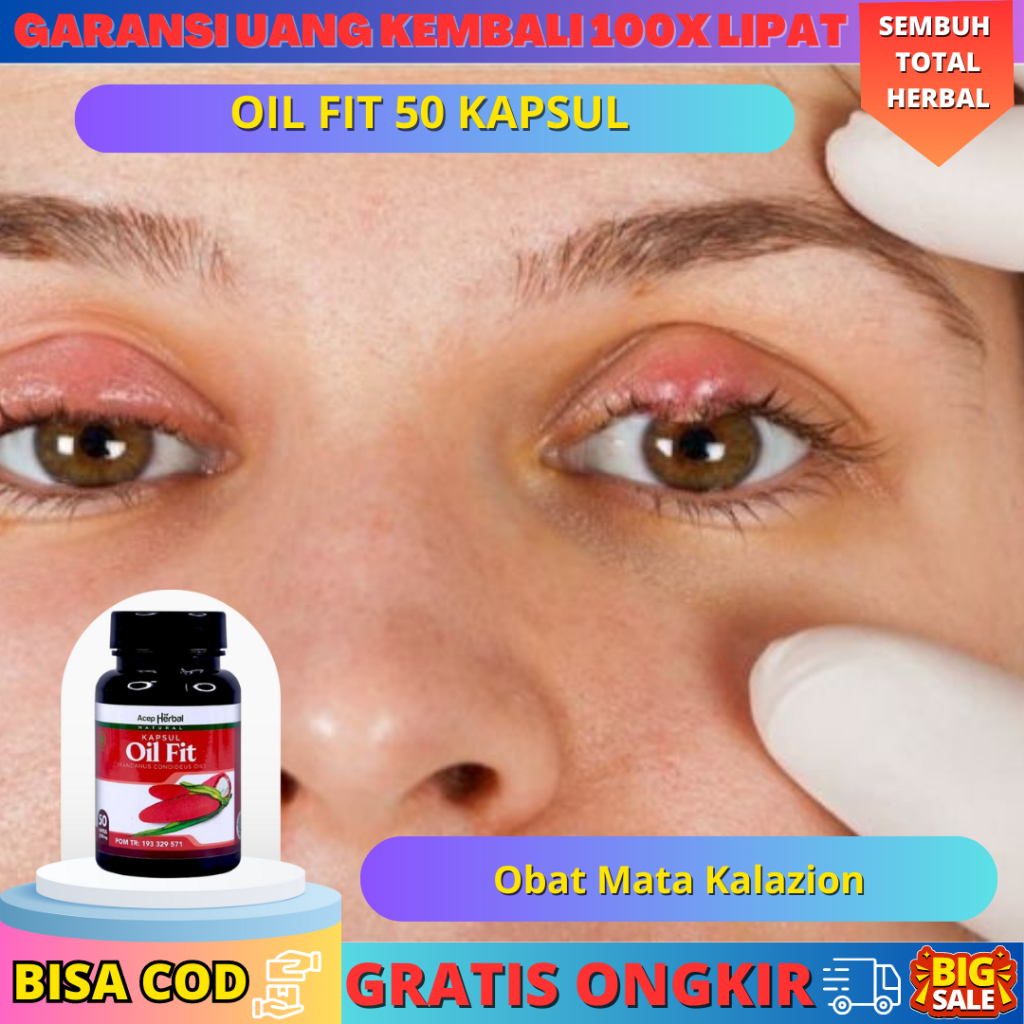Obat Mata Kalazion Timbilan Bintitan Benjolan Dekat Mata Oil Fit 50 Kapsul