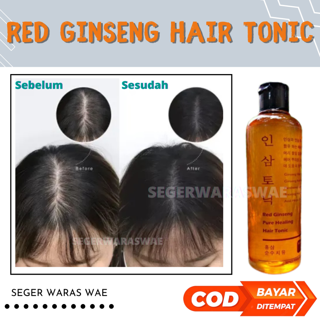 Red Ginseng Hair Tonic Korea Vitamin Penumbuh Rambut Botak Rusak Kering Kusam