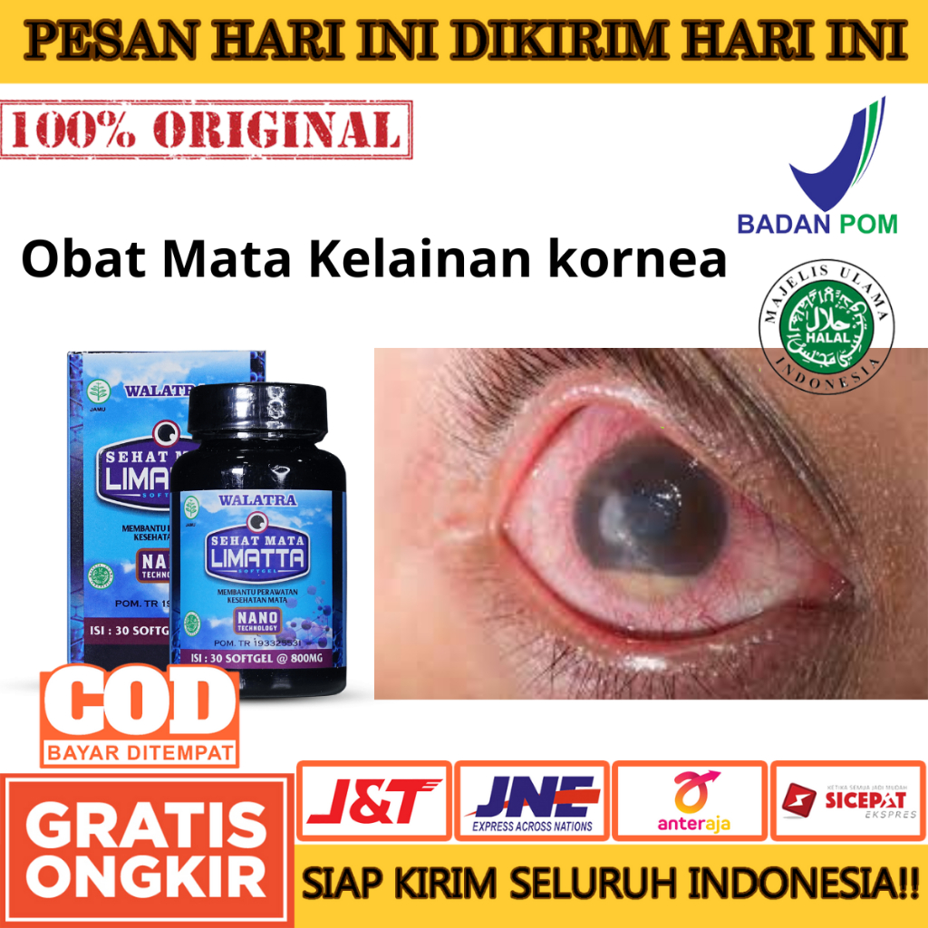 Obat Mata Konjungtivitis, Mata Kelainan Refraksi, Gangguan Retina, Amblyopia - Sehat Mata Limatta 10