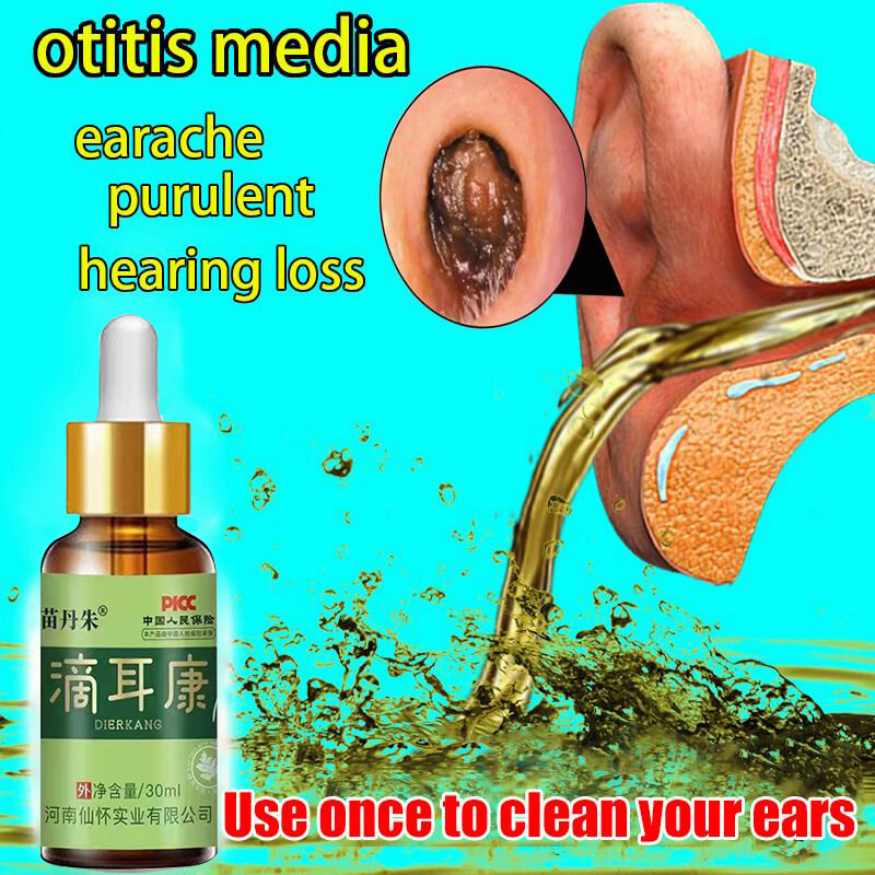 Obat tetes telinga pelembut,obat telinga,obat penyumbat telinga 30ml penyedot kotoran telinga untuk 