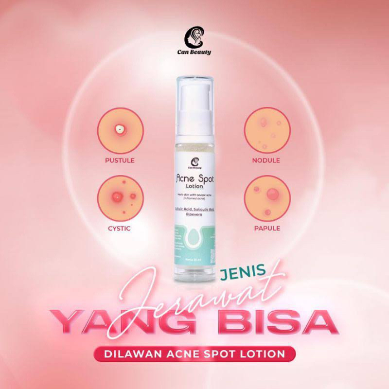ACNE SPOT LOTION CAN BEAUTY AMAN BUMIL BUSUI BPOM