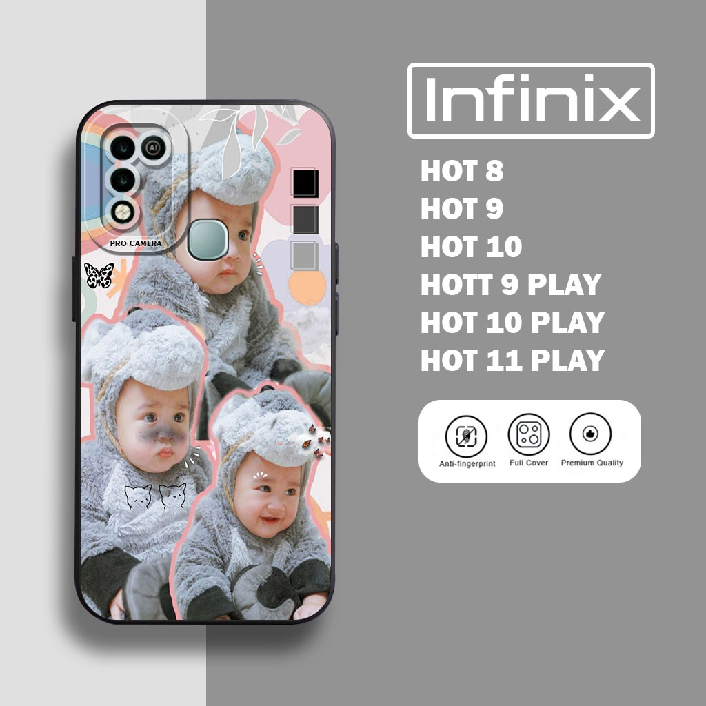 Case Infinix Hot 8 hot 9 hot 10 Infinix hot 9 play 10 play 11 play Kesing Motif Cipung - Soft case Infinix HOT 9 HOT 8 HOT 10 - Silicon Hp Infinix - Kessing Hp Infinix - sarung hp - kesing hp - aksesoris handphone terbaru - case infinix -  casing murah
