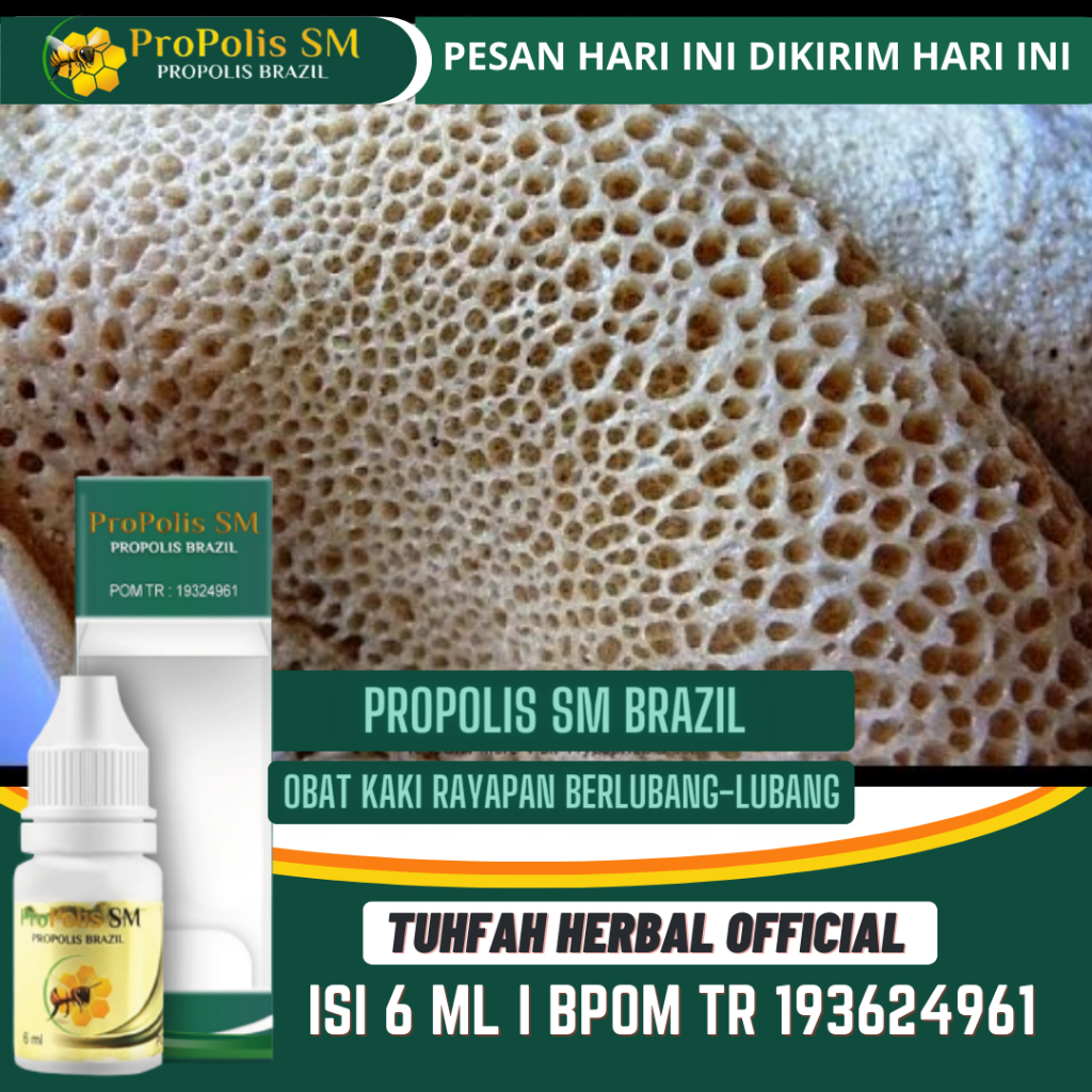 Obat Kaki Rayapan & Bau Telapak Kaki Rayapan Berlubang Telapak Kaki Rorombeheun Penghilang Kaki Raya