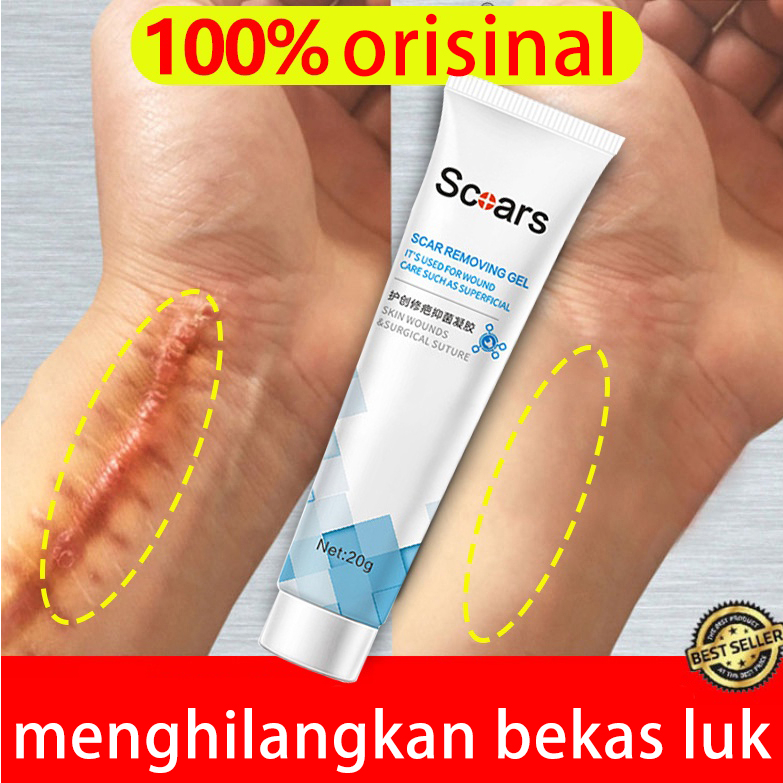 penghilang bekas luka Krim bekas luka menghilangkan Bekas Luka stretch mark Krim Perbaikan hitam kor