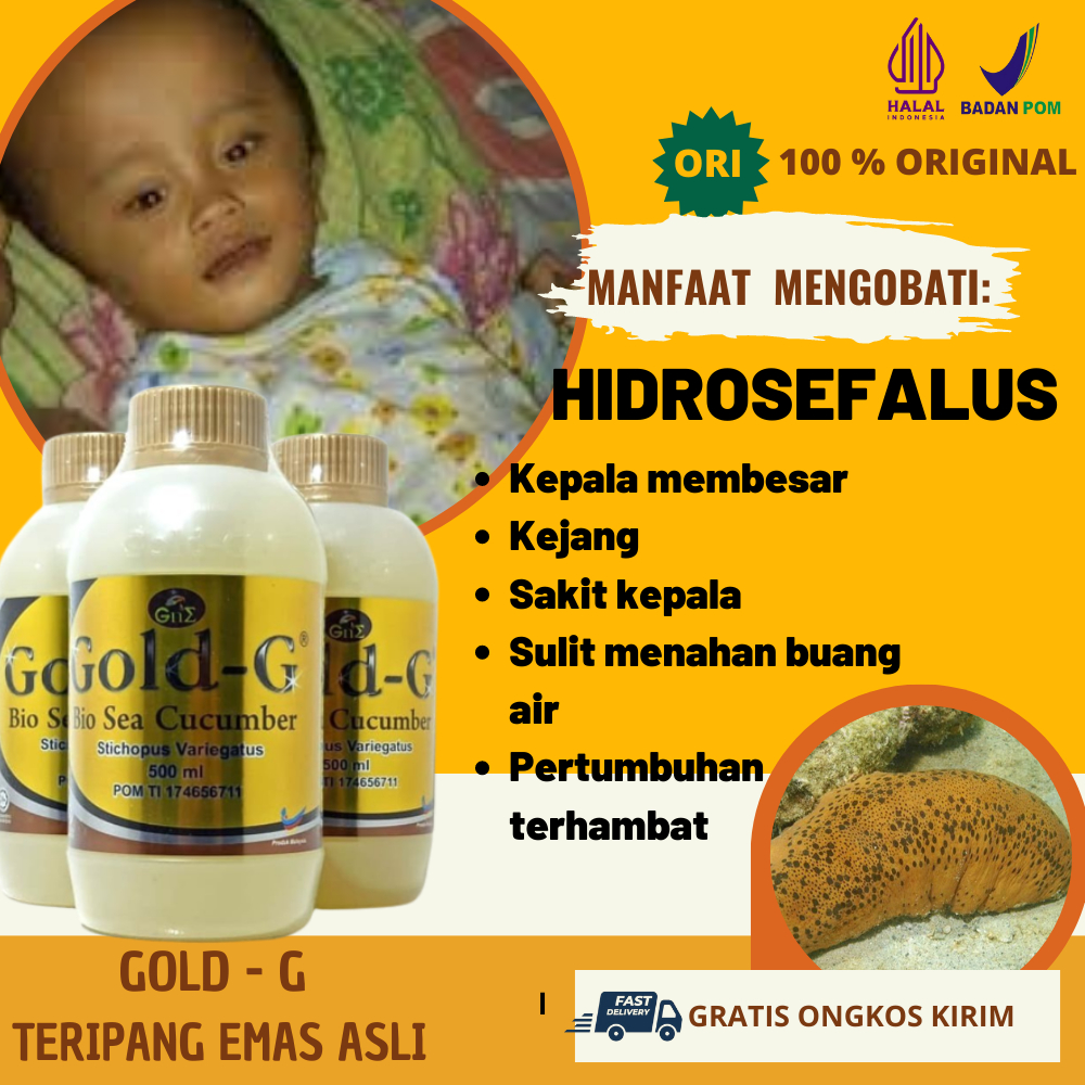 Gold-G Jellly Gamat Obat Hidrosefalus Pada Anak Tanpa Efek Samping