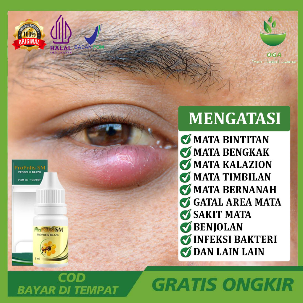 Obat Mata Bintitan Cendo Bengkak Belekan - Propolis ASLI BPOM ORIGINAL