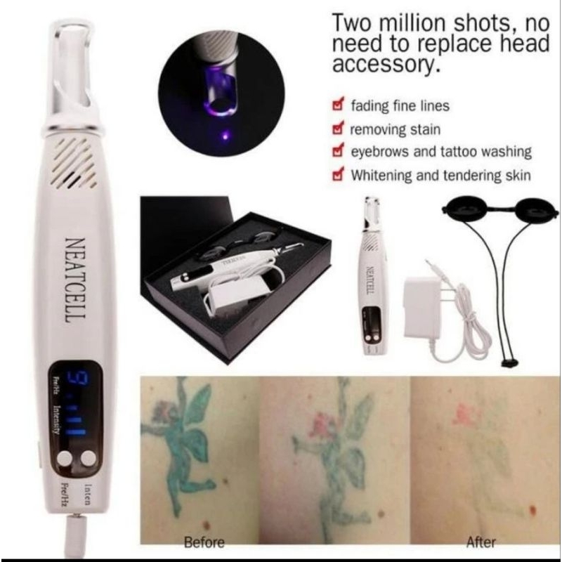 neatcell picosecond laser pen penghilang tatto