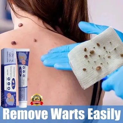 back Wart Drugs Warten Mole Cholesterol Mole Removal Wart Cream Wart Removal Ointment Warts Skin Tag