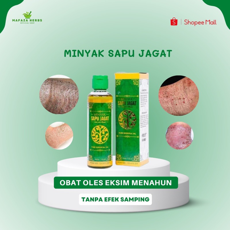 Mafaza Herbs - Obat Eksim Menahun, Eksim Kering, Eksim Basah, Salep Eksim, Gatal Kulit Eksim, Eksim 