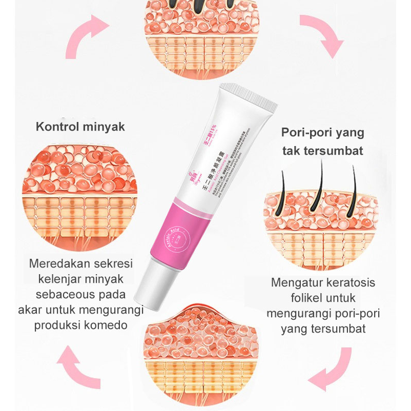 Acne Cream Krim Jerawat Azelaic Acid Cleansing Gel 30ml  Jerawat untuk Menyembuhkan dan Mengempeskan Jerawat | Acne Spot | Night Day Cream | Essence | Skincare Skin