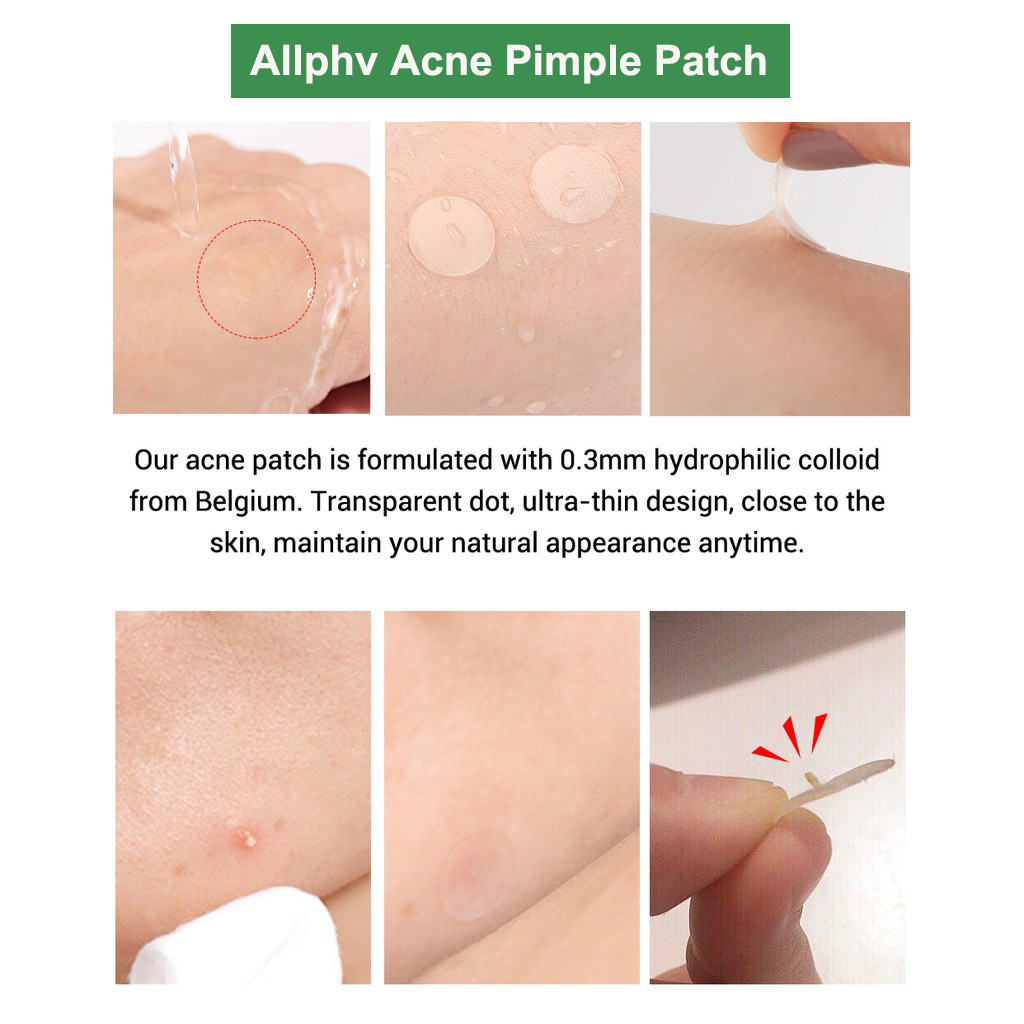 [Ori100%]ALLPHV Acne Patch - Jerawat Stickers /Penghilang Jerawat /Focalure Acne Patch