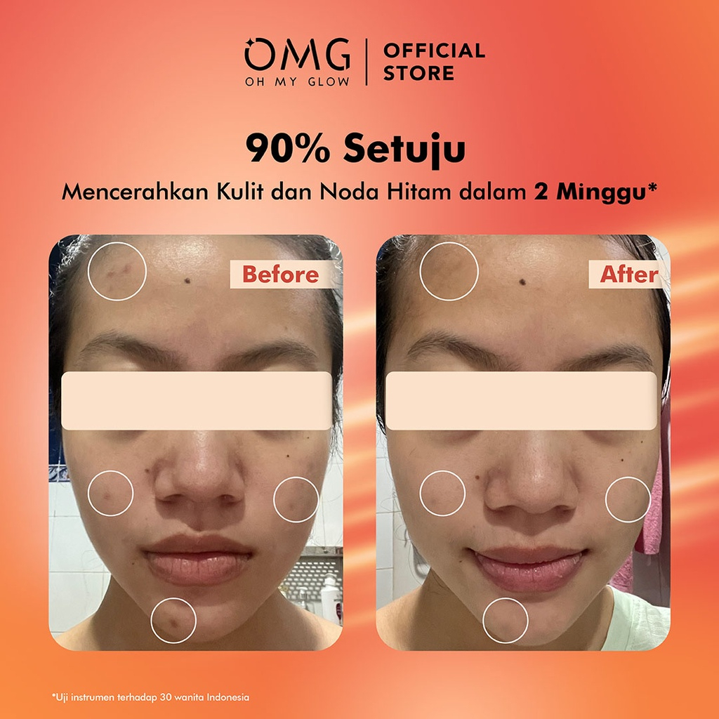 [SACHET 7,5ML | BPOM] OMG OH MY GLOW Peach Glowing Serum 7,5 ml - Serum Pencerah untuk Kulit Sehat &amp; Glowing_Cerianti