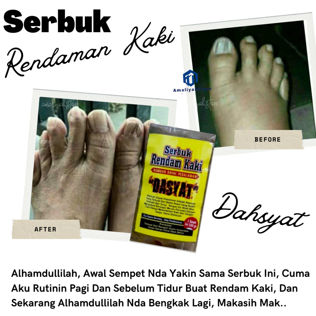 Serbuk Herbal Terapi Rendaman Kaki Bengkak Rempah Ramuan Herbal Asli Dayak Foot Therapy Untuk Rendam Kaki Pria Dan Wanita Ampuh Original