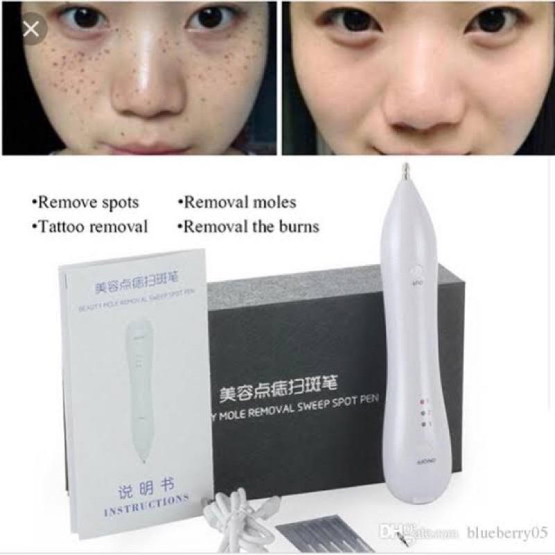 Laser beauty Removal Pen Alat Penghilang Flek Kutil Tahi Lalat