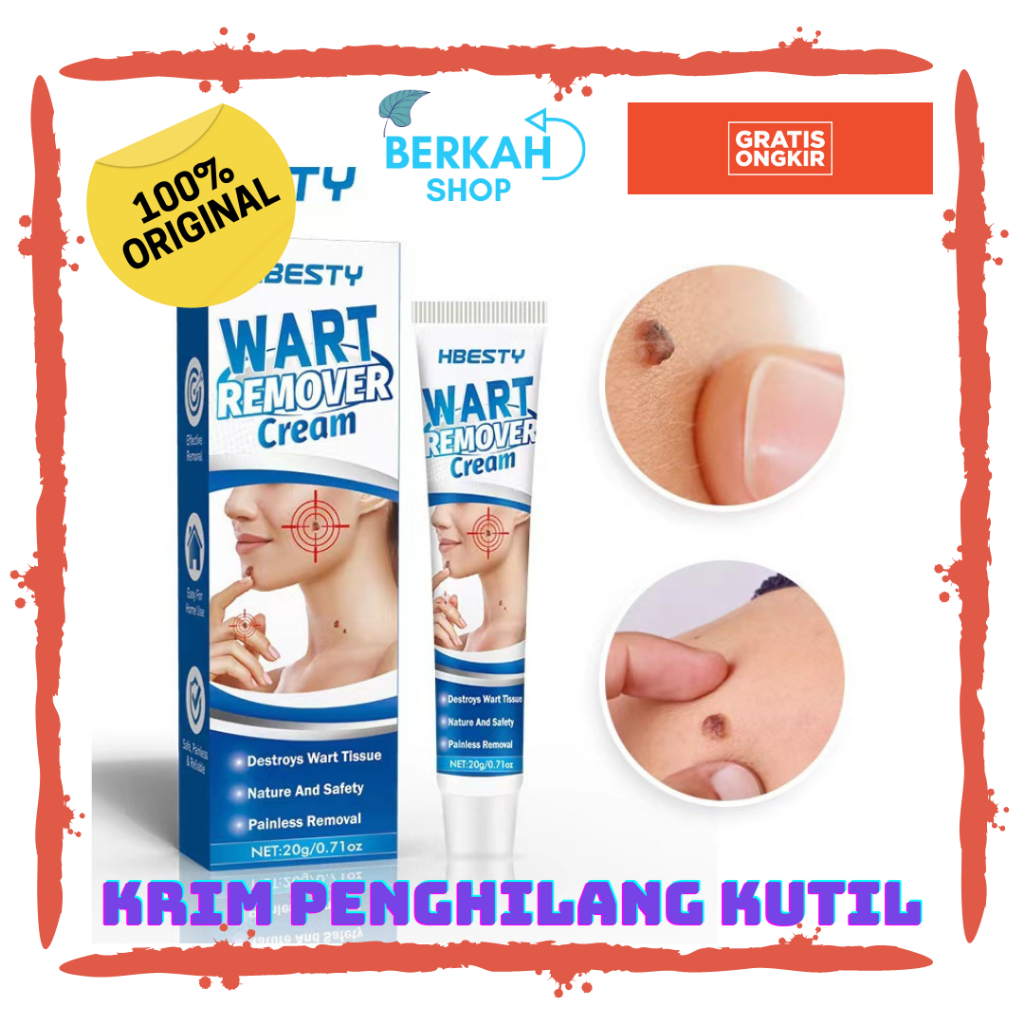 krim cream kutil wajah mata ikan tahi lalat