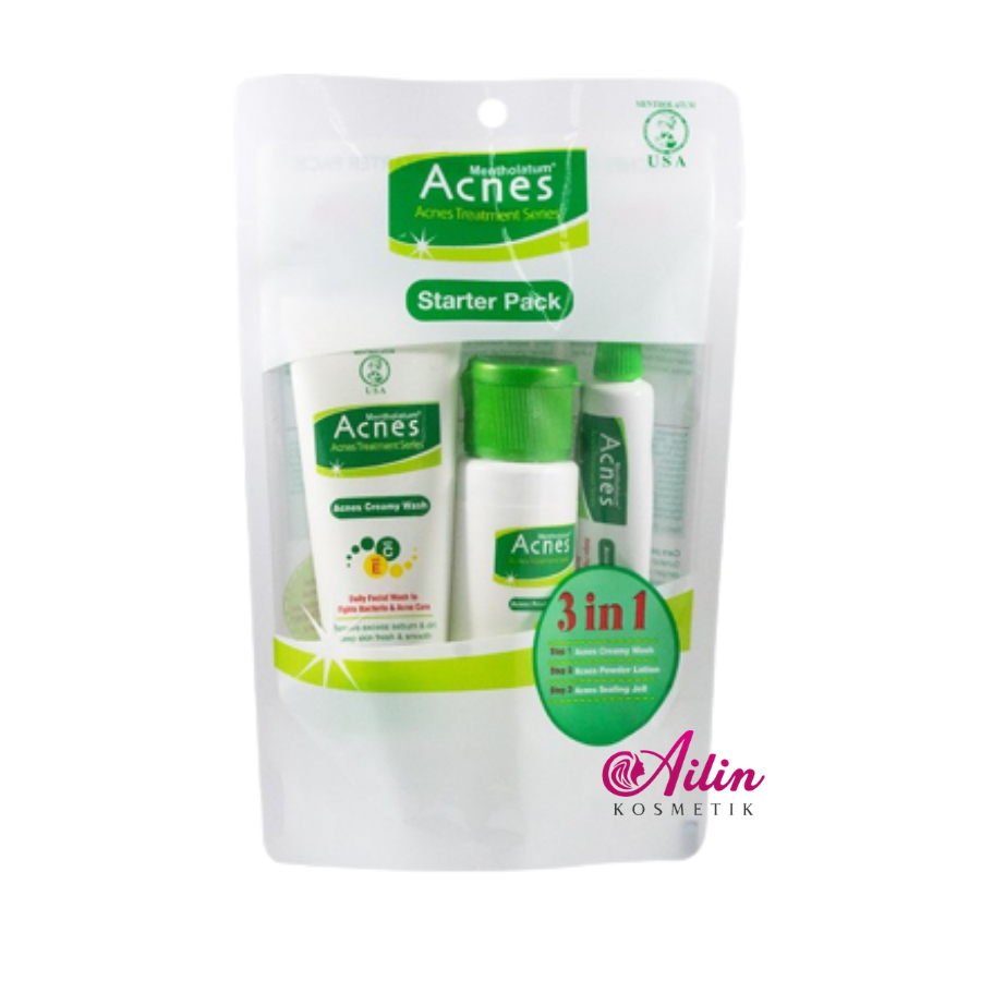 ACNES Starter Pack Creamy Powder Lotion Sealing Jell by Ailin