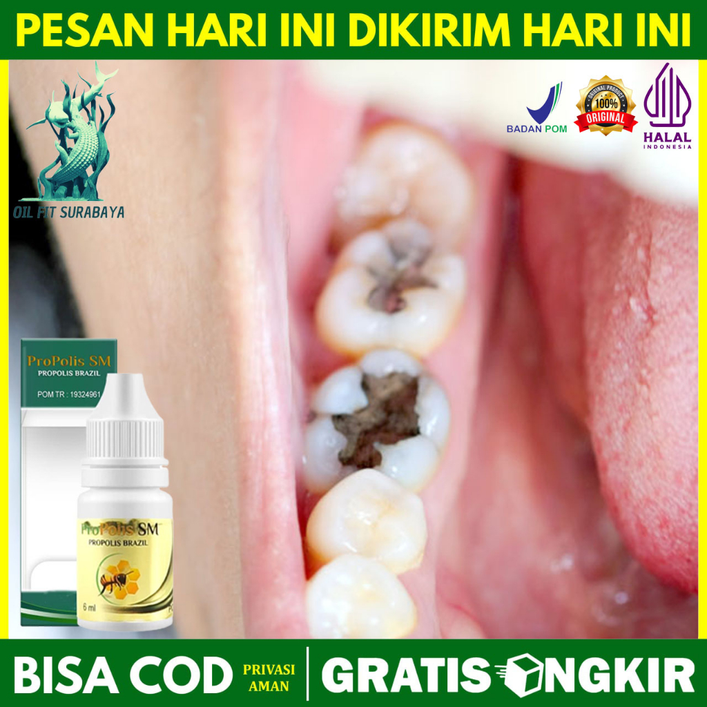 Obat Pembunuh Ulat Gigi di Apotik - Cara Mengeluarkan Ulat Gigi - Ulat Dalam Gigi Yang Berlubang - C