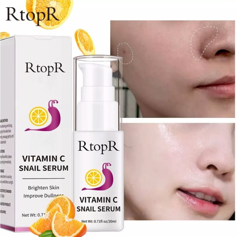 RTOPR VITAMIN C SERUM SNAIL BRIGHTENING FADE DARK SPOT LIGHTENING SERUM BRIGHTENING SKIN SERUM BEKICOT ANTI