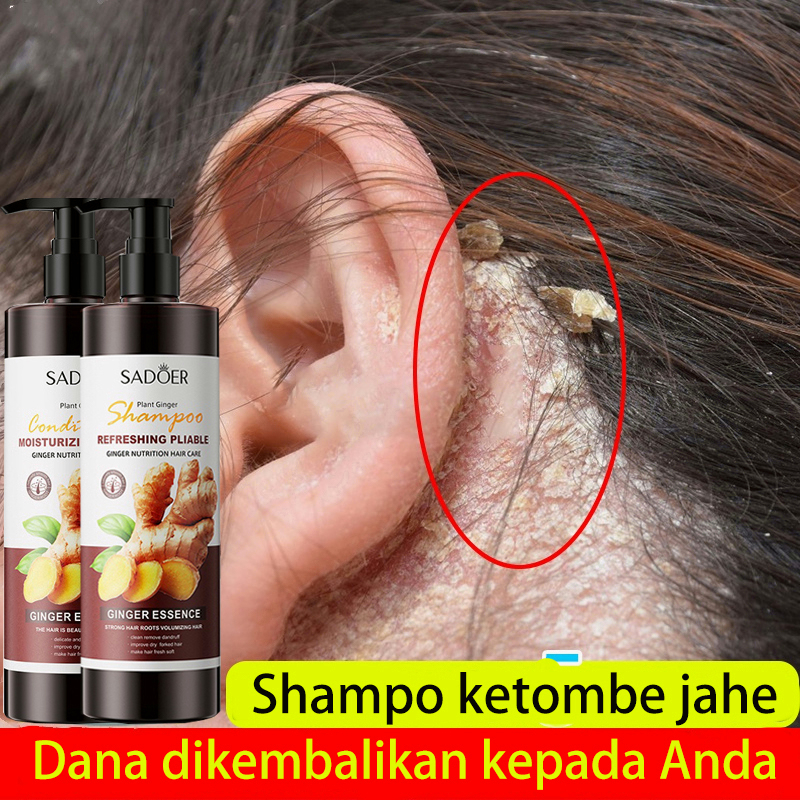 SADOER Sampo Anti Ketombe Ginger Shampoo / Conditioner / Hair mask /Hair Care Set Anti-hair loss Dandruff Frizz Fork Supple